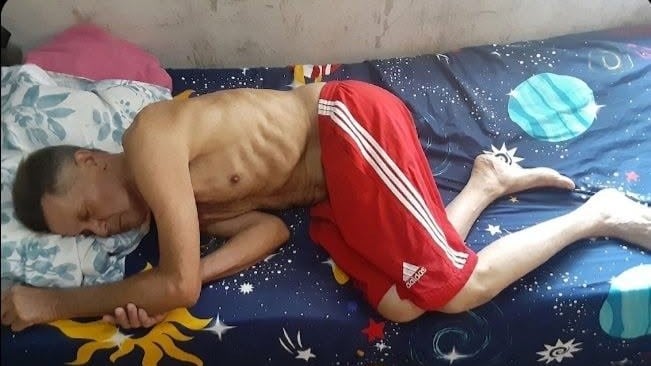 Guillermo del Sol en huelga de hambre contra el régimen cubano.